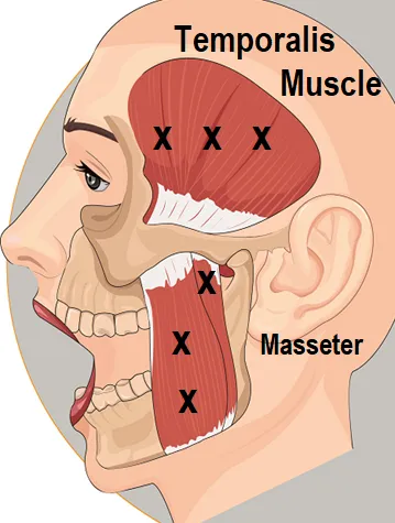 Self-paced Home Study 12 CE Hour Chair Event Massage with Trigger Point Therapy