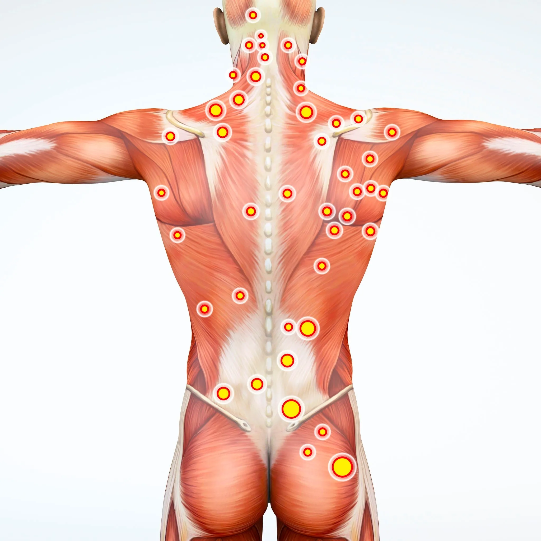 Self-paced Online Home Study 12 CE Hour Trigger Point Therapy & Myofascial Release